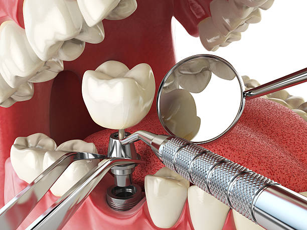 Best Urgent Tooth Repair  in Oxford, PA